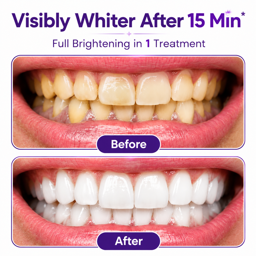 ✅ Formixx Pro Teeth Whitening Strips | Instant Whitening in 15 Minutes