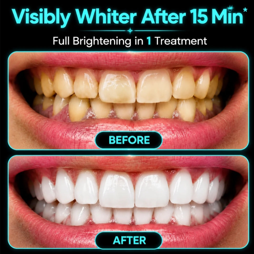 ✅Formixx Black Teeth Whitening Strips | Professional Whitening Results at Home(Ultra Strong Whitening)